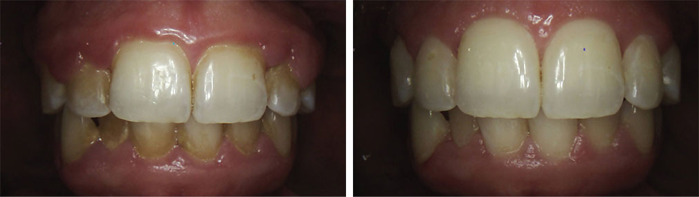 Root Planing and Scaling #2 in Lakewood, NJ